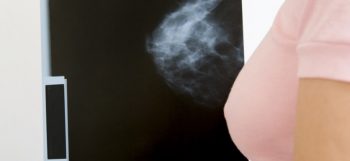 woman holding mammogram x-ray