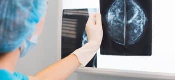 doctor looking at mammogram results