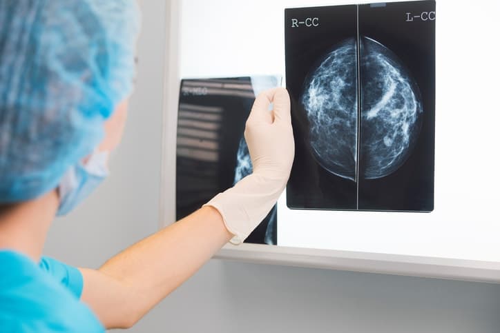 doctor looking at mammogram results 