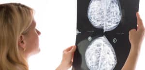 Breast Cancer Mammograms in Long Island, NY | Breast Cancer Screening | PURE Mammography