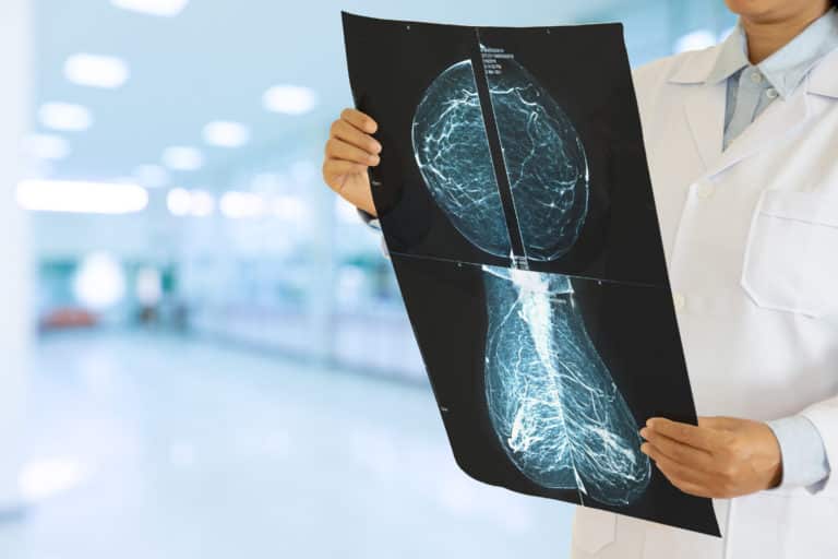 Types of mammograms screening diagnostics lake grove ny
